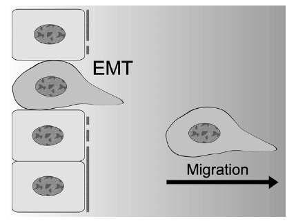 EMT 모식도