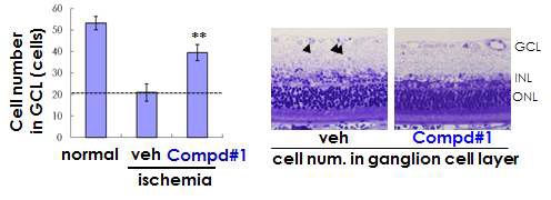 그림 94. 녹내장 동물모델에서의 Compd#1의 시신경세포죽음 보호효과