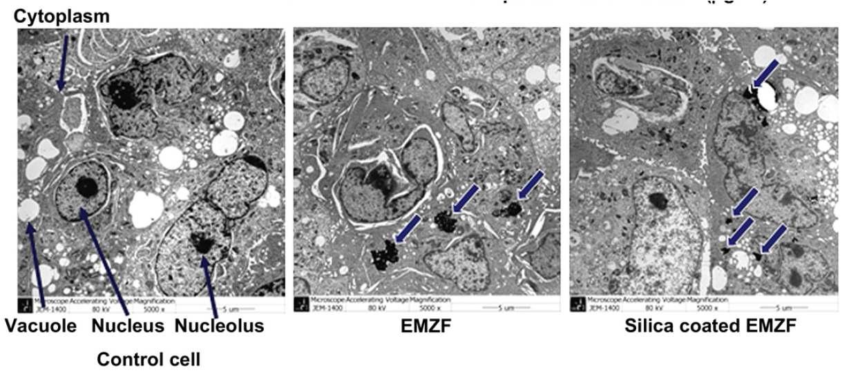 신경절세포에 여러 가지 EMZF particle 처리를 한 후의 TEM 사진