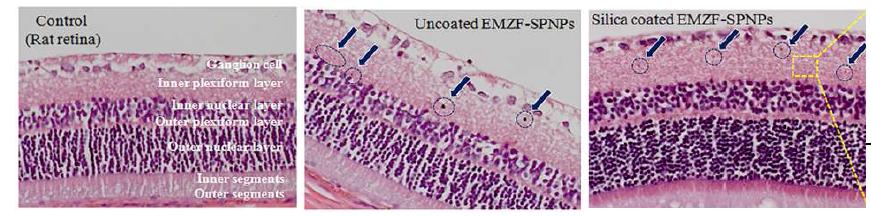 쥐 유리체강내에 EMZF 주입후의 망막조직소견