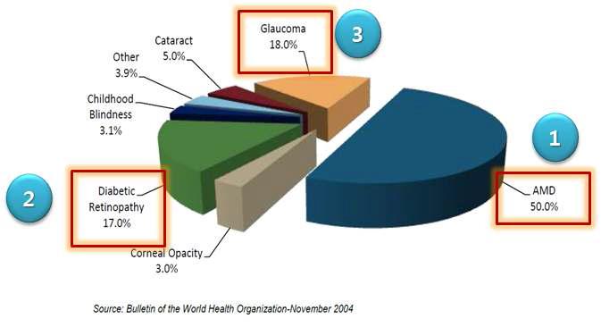 미국에서의 실명 주요 원인 질환