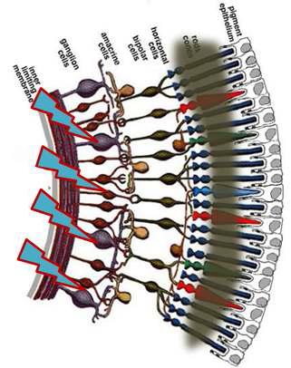 망막절세포에 대한 자극방법 원리