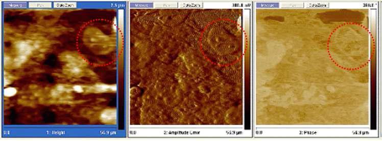 osteoclast 세포조직에 의해우서) 침am식p당lit한ud ed eenrtrionre idmisakg esurface의 image.