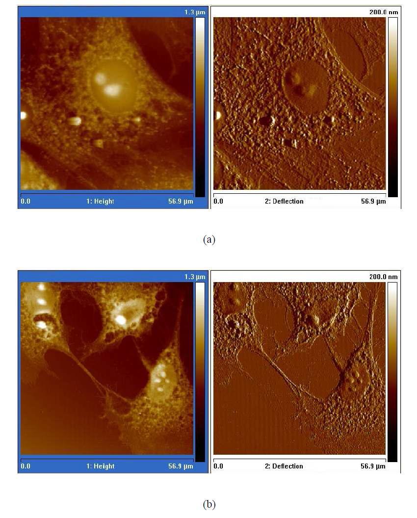 정상 쥐(a) 및 골다공증을 앓는 쥐(b)의 Chondrocyte 세포의 AFM image