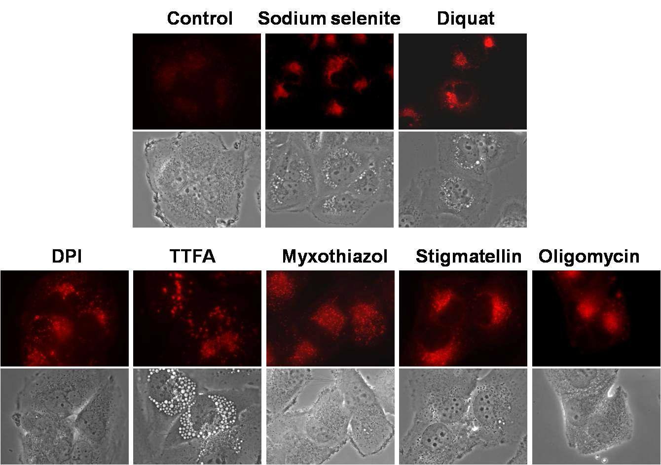 악성 glioma 세포에서 mitochondrial complex inhibitor들과 selenite 및 diquat 처리에 의한 autophagosome 생성