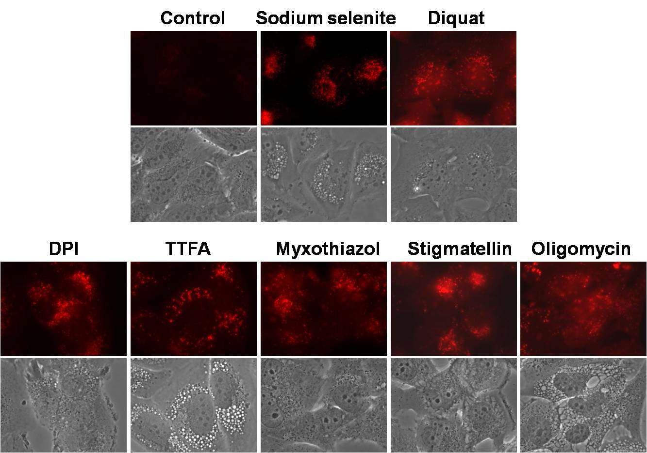 악성 glioma 세포에서 mitochondrial complex inhibitor들과 selenite 및 diquat 처리에 의한 acidic vesicular organelle의 생성