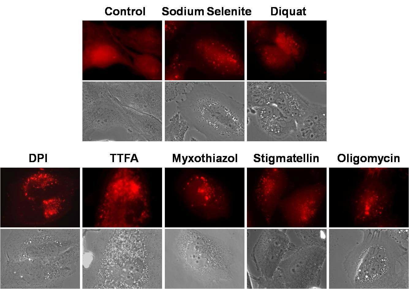 Glioma 세포에서 mitochondrial complex inhibitor들, selenite, diquat 처리 후 LC3의 autophagosome 으로의 translocation 여부 확인