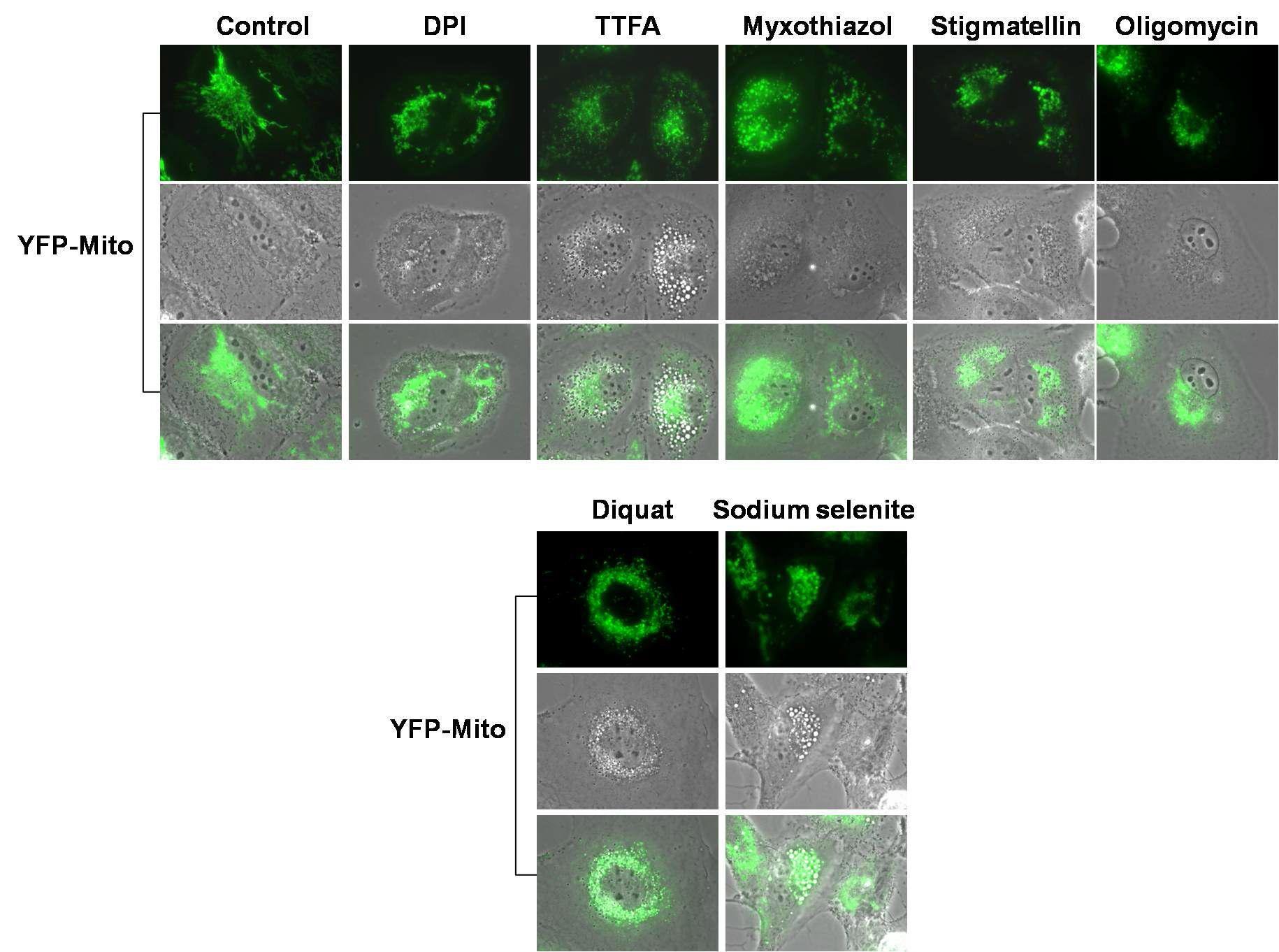 Malignant glioma 세포주에서 mitochondrial complex inhibitor들과 diquat 또는 selenite 처리 후 mitochondria 구조 변화 관찰