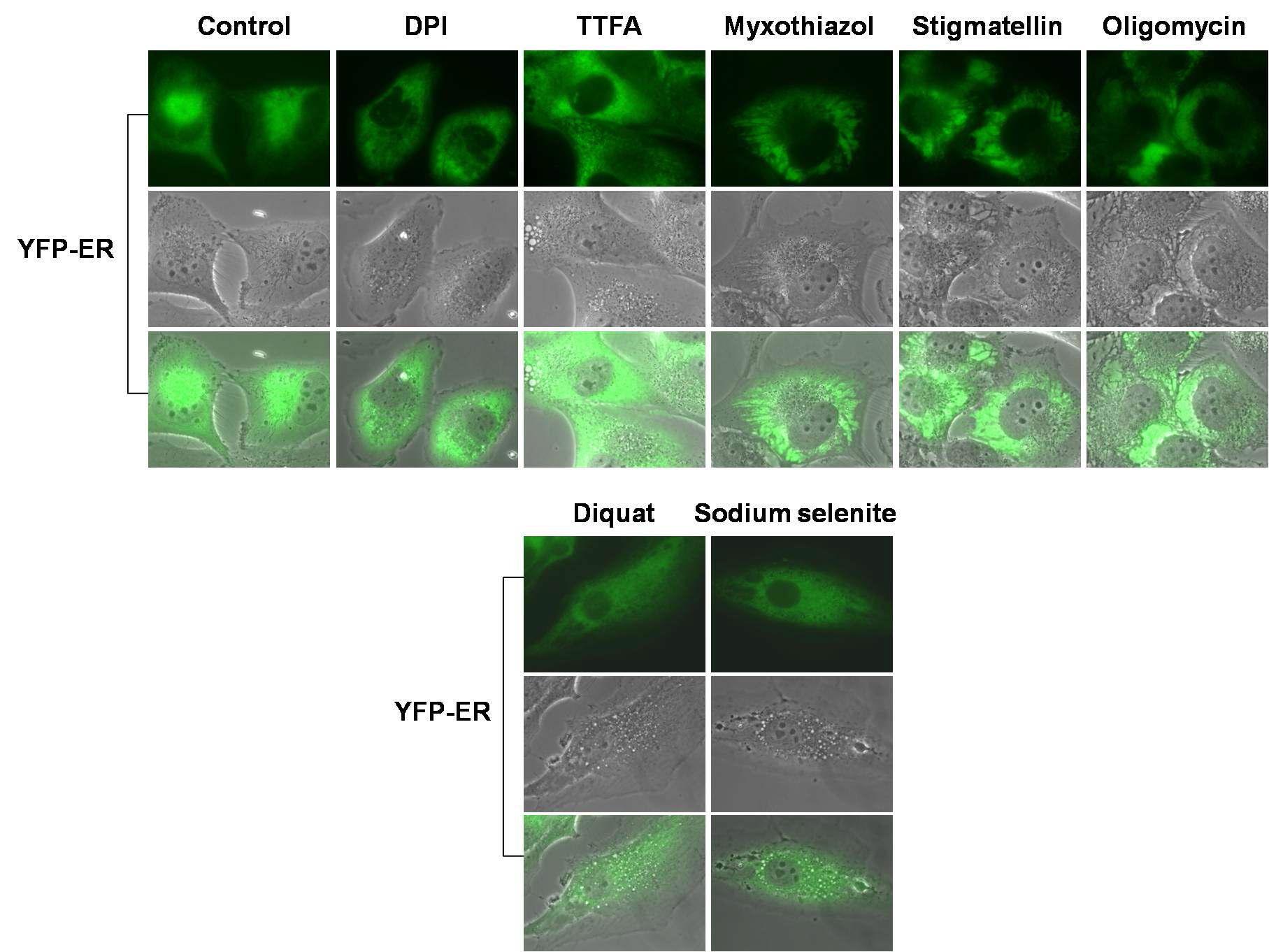 Malignant glioma 세포주에서 mitochondrial complex inhibitor들과 diquat 또는 selenite 처리 후 ER 구조 변화 관찰