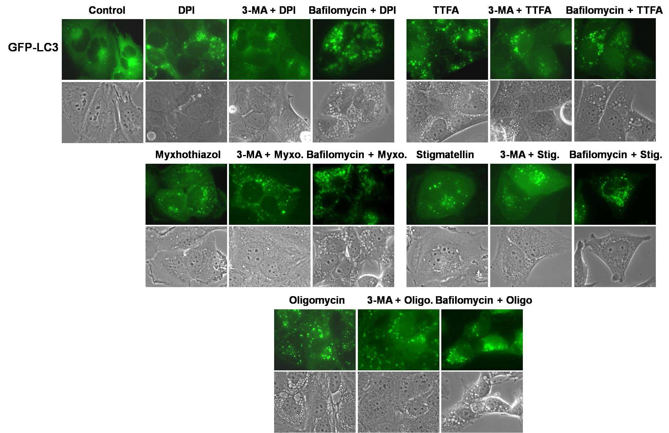 악성 glioma 세포에서 mitochondrial complex inhibitor들에 의한 autophagosome 형성 유도 시autophagy inhibitor 선처리 효과 분석