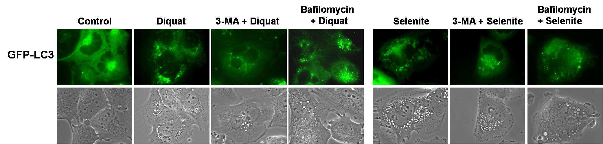 악성 glioma 세포에서 diquat 혹은 selenite에 의한 autophagosome 형성 유도 시 autophagy inhibitor 선처리 효과 분석