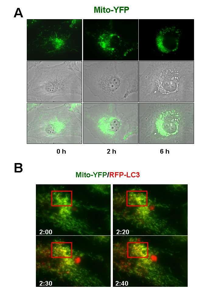 Selenite에 의한 mitophagy 유도