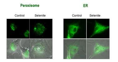 Selenite 처리 후 peroxisome과 ER의 구조 및 분포 변화