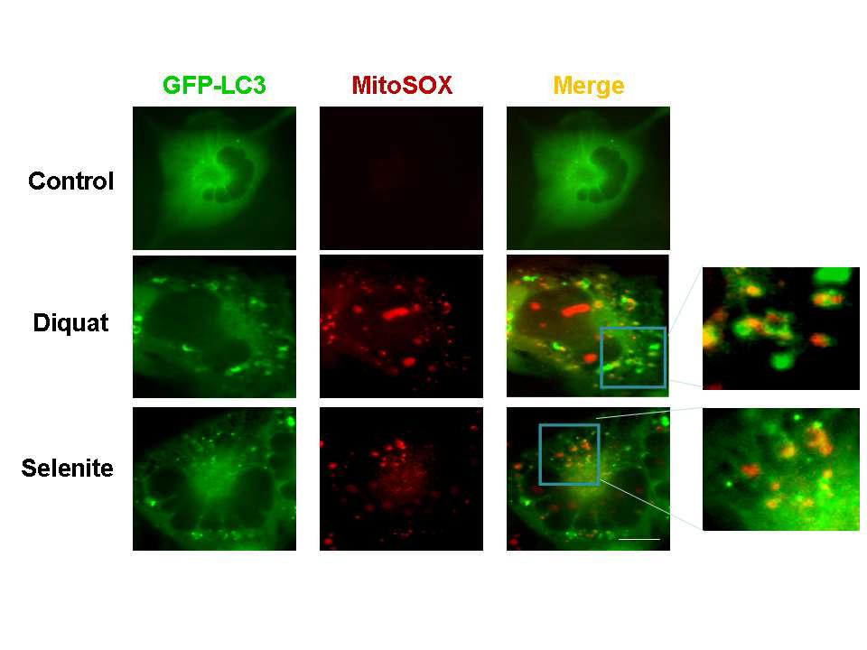 Mitochondrial superoxide generators에 의한 autophagy 유도