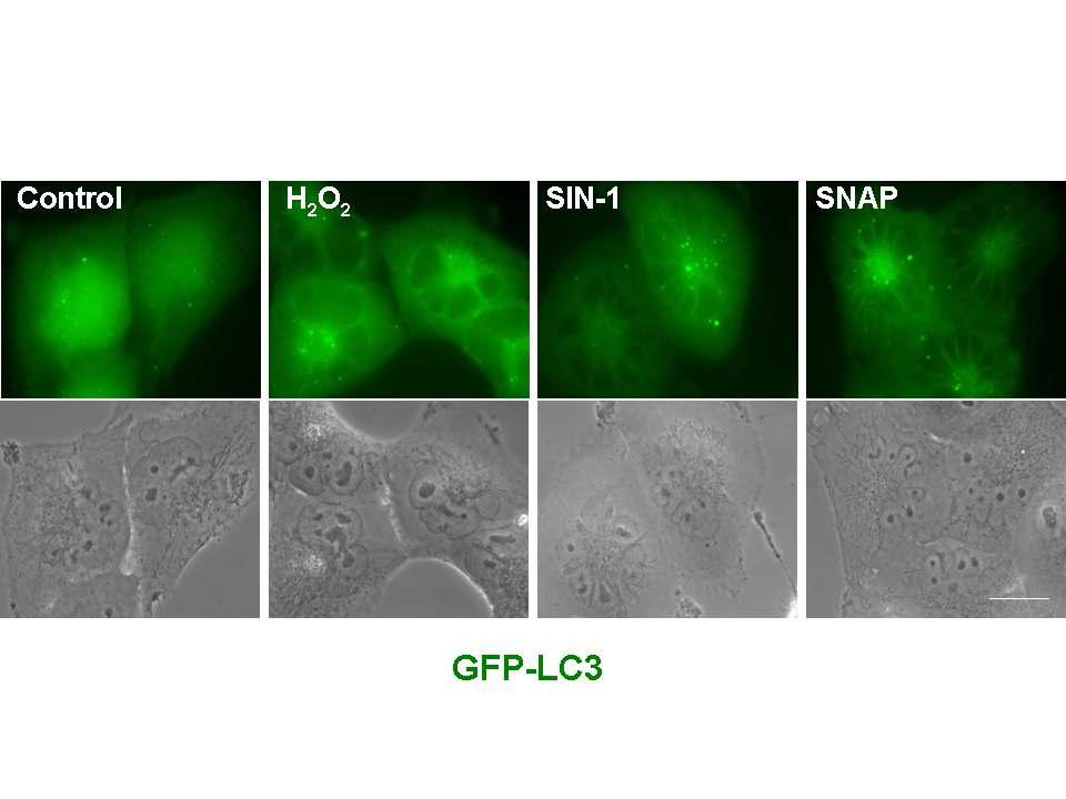 각종 ROS generators에 의한 LC3 translocation 확인