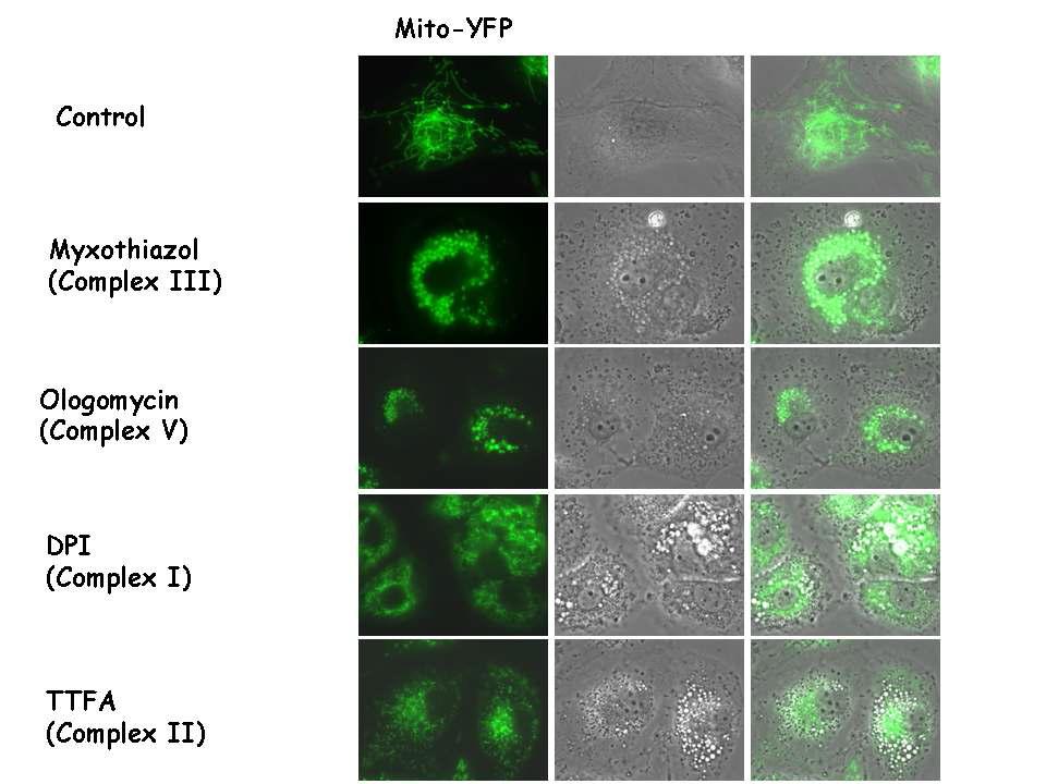 각종 mitochondrial complex inhibitors에 의한 mitochondria의 구조 변화와 vacuolation 확인