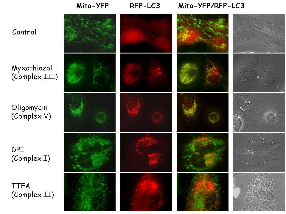 각종 mitochondrial complex inhibitor 처리 후 mitochondria의 구조 변화와 LC3의 co-localization 확 인.