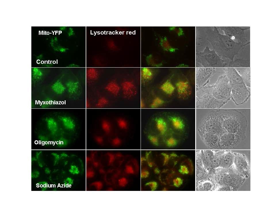 Mitophagy inducer 처리 후 mitochondria와 lysosome의 위치 확인