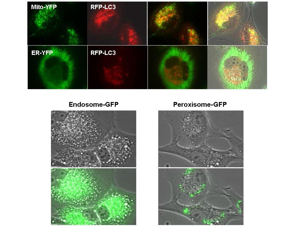 Monensin 처리 후 각종 organelle과 LC3, autophagic vacuole과의 위치 관계