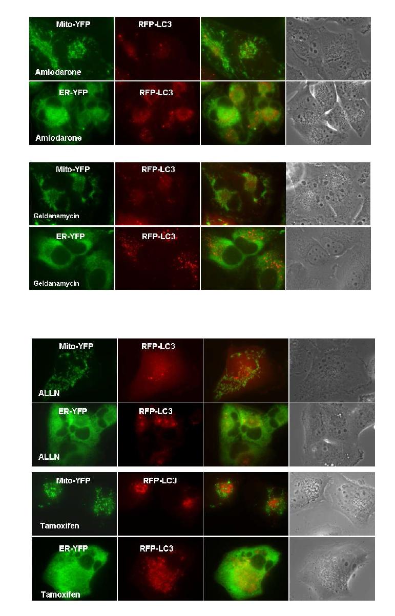 다양한 autophagy inducer 처리 후 mitochondria 또는 ER과 LC3와의 co-localization 분석