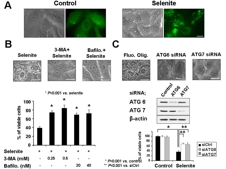 A. Selenite에 의한 LC3 translocation. B. 각종 autophagy inhibitor를 선처리한 후 selenite 처리 시 세포 모양 변화와 세포 사멸에 미치는 효과 분석. C. ATG6 또는 ATG7의 siRNA transfection 후 selenite 처리 시 세포 모양 변화와 세포 사멸에 미치는 효과 분석.