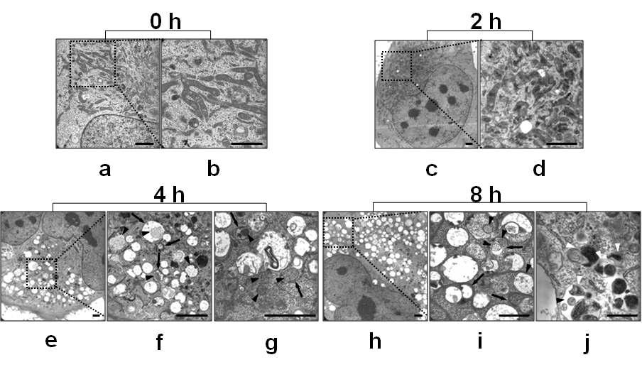 μM selenite를 각 시간동안 처리한 T98G 세포에서 전자 현미경 관찰. Bar, 2 μm.