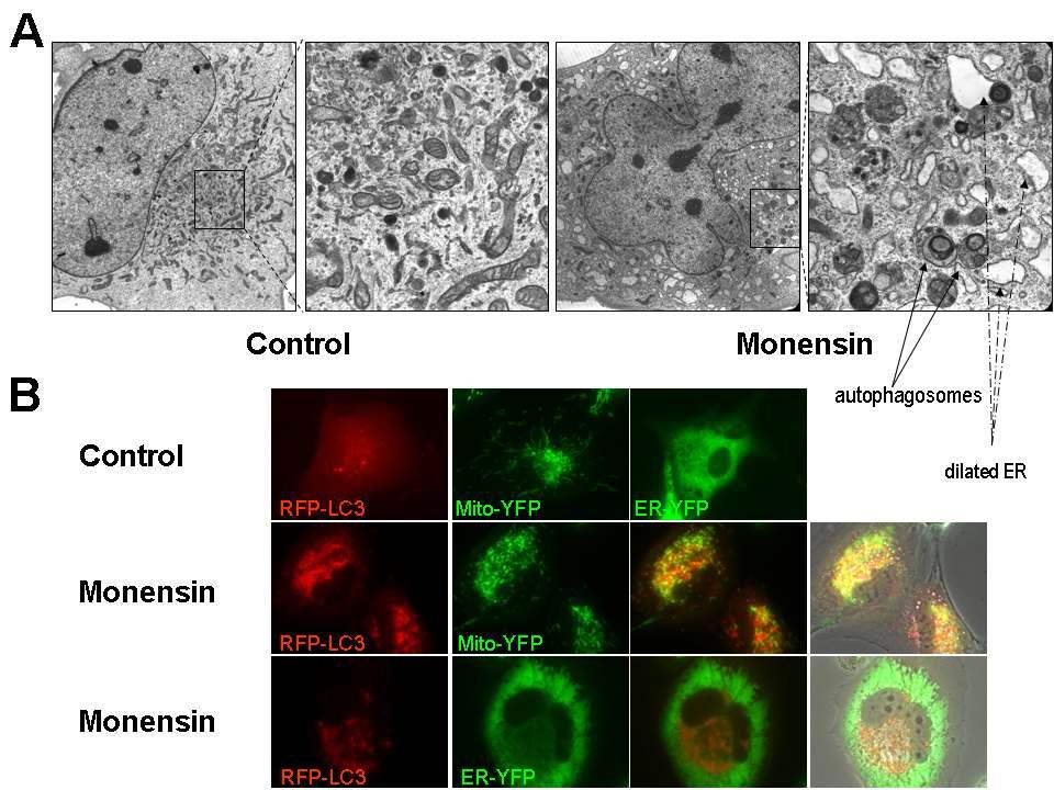 Monensin에 의한 autophagosome 축적 및 ER 팽창 유도