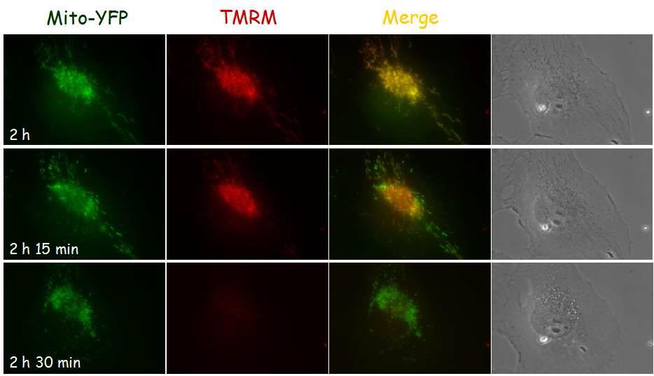 Selenite를 처리한 Mito-YFP cell에서 TMRM 염색 후 형광 현미경 및 위상차 현미경으로 time-lapse imaging 수행.