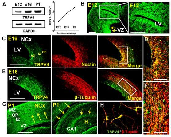 배아 뇌조직에서 TRPV4 채널의 발현 양상