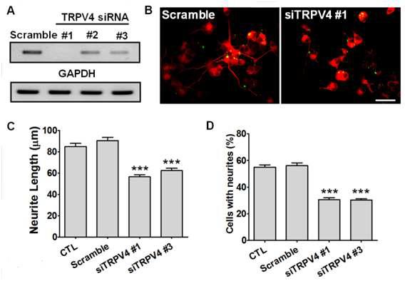 PC12 세포에 TRPV4 채널 siRNA를 이용한 제거