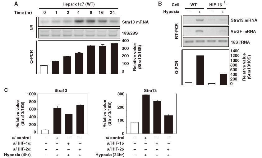 Involvement of Stra13 on the expression of SREBP-1c.