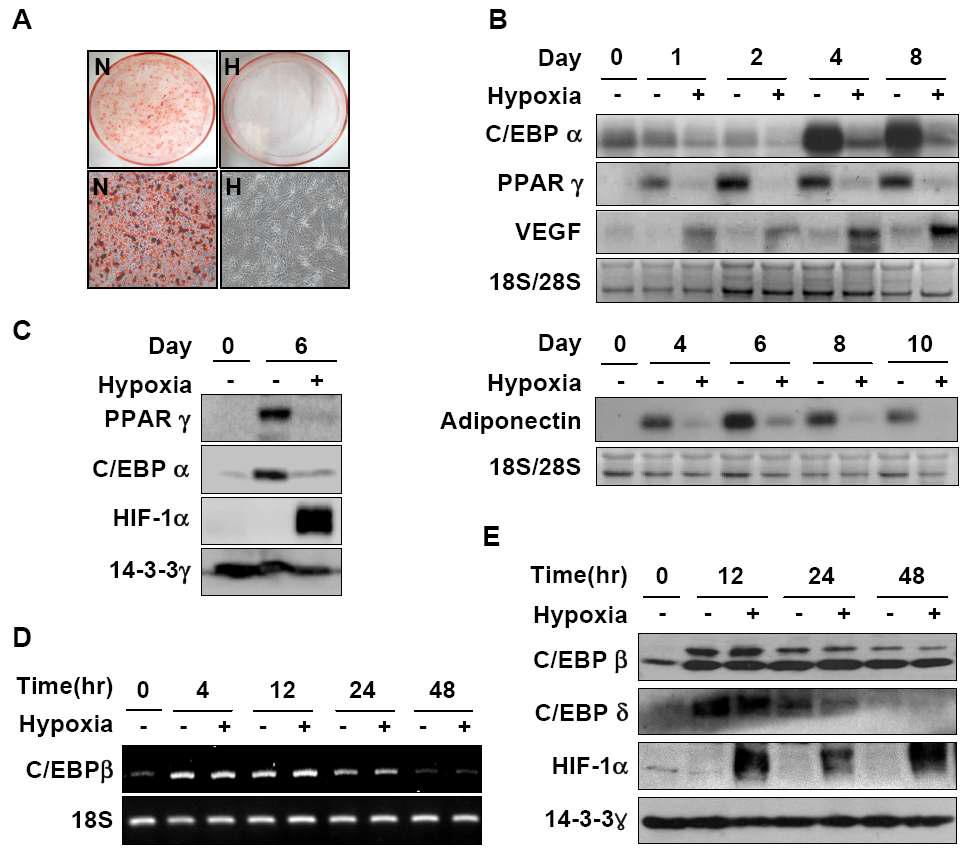 Expression of PPARγ, C/EBPα, C/EBPβ, and C/EBPδ during adipogenesis.