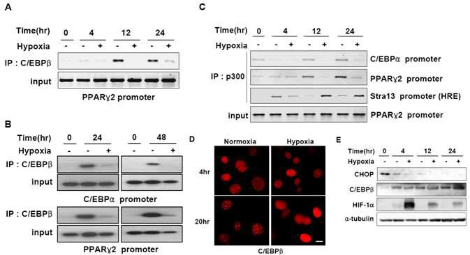 DNA-binding activity and heterochromatin localization of C/EBPβ