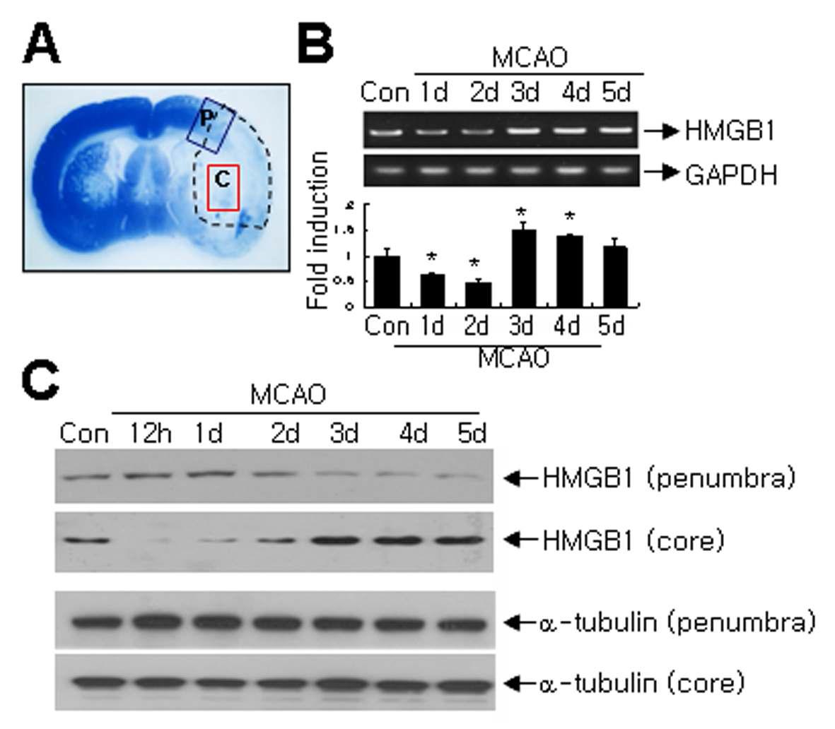 1시간 MCAO 후 시간경과에 따른 HMGB1의 양을경색반구전체 (점선, B), 경색중심 (C),와 경색경계부위 (P)를 구분하여 조사함.