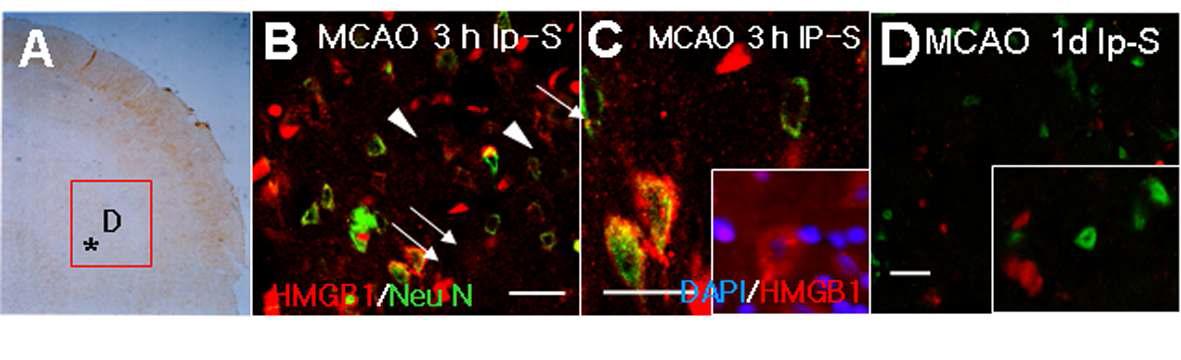 MCAO 후 재관류 3h (A-C)와 1일 (D)의 경색반구 선조체에서의 HMGB1의 발현을 면역조직화학 염색법으로 조사.