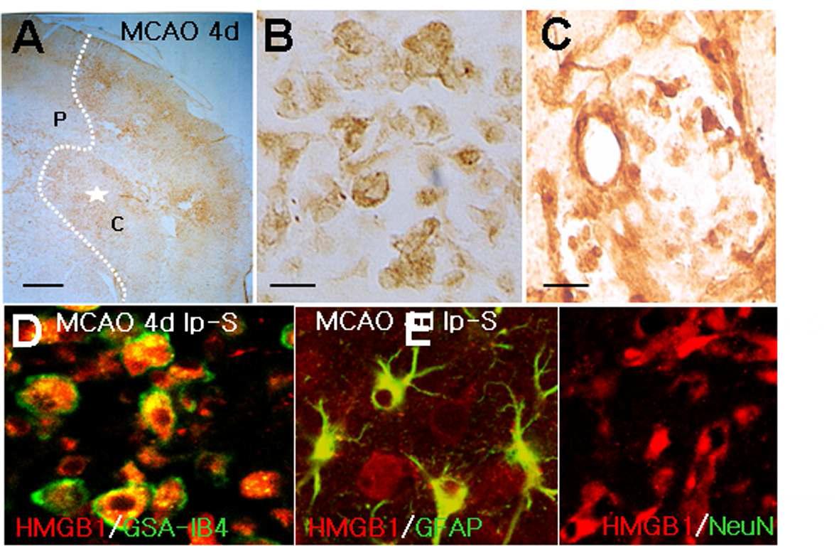 MCAO 후 재관류 4일의 경색반구에서의 HMGB1의 발현을 면역조직화학 염색법으로 조사.