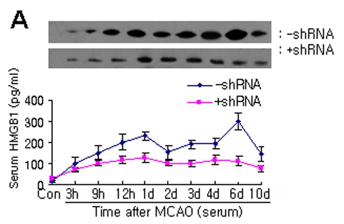HMGB1 siRNA 발현 플라스미드 주입에 의한 serum HMGB1 level 변화를 RT-PCR로 조사하였슴.