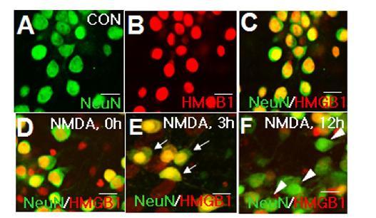 대뇌피질 1차 배양 신경세포에 NMDA 처리 후 3, 12, 24 시간 후에 신경세포에서의 HMGB1의 분포를 면역 세포염색법으로 조사.