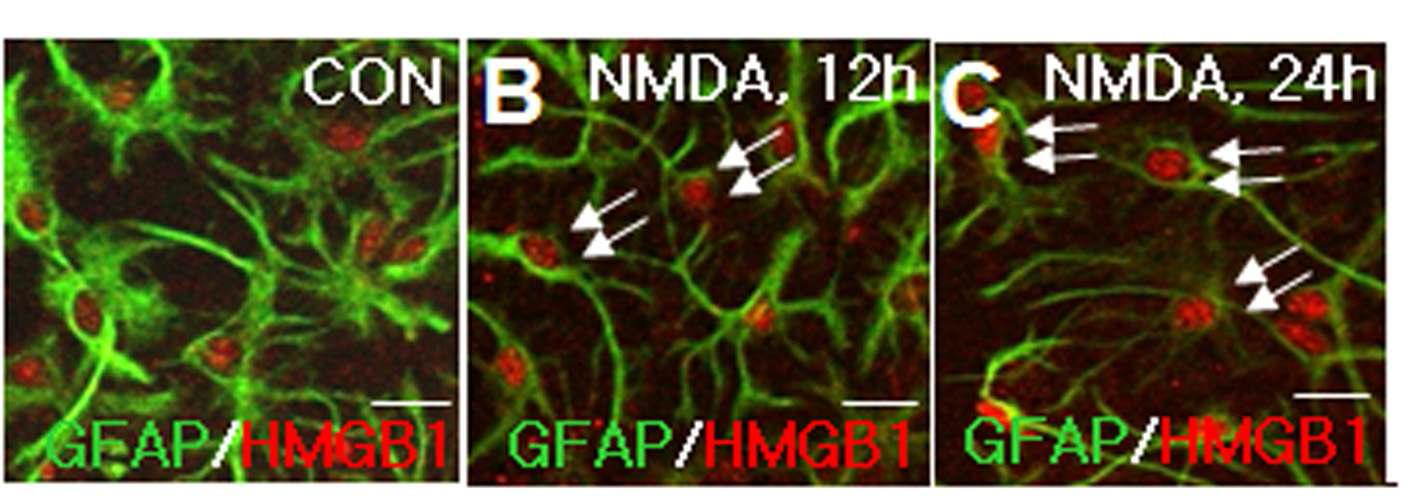 대뇌피질 1차 배양 신경세포에 NMDA 처리 후 3, 12, 24 시간 후에 별글리아 세포에서의 HMGB1의 분포를면역 세포염색법으로 조사.