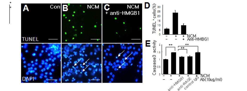 대뇌피질 1차 배양세포의 NMDA-conditioned media(NCM)을 처리한 후 TUNNEL staining(A-C)과 casapse 3 활성(E)을 조사. 이 때 HMGB1 항체 처리의 효과를 조사하였슴