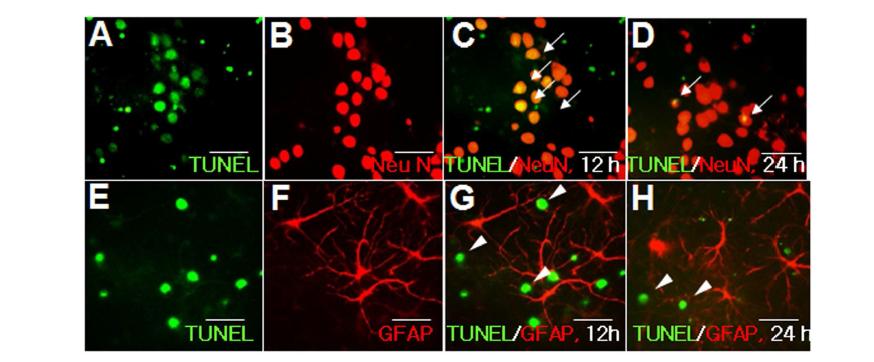 대뇌피질 1차 배양세포에 NCM 처리 후 12 시간, 24시간 후에 TUNNEL과 NeuN (A-D), TUNNEL과 GFAP (E-H)의 이중 형광염색 을 수행하였슴.