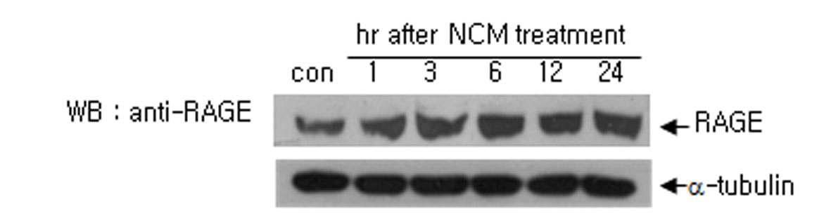 NCM 처리 후 24시간까지의 RAGE 단백질 양을 immunoblot을 통하여 조사함.