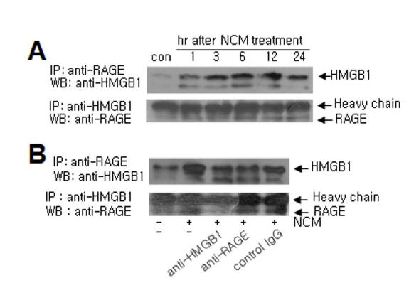 NCM 처리 후 1시간부터 24시간까지 CO-IP 실험을 통해 HMGB1과 RAGE의 protein간의 결합을 조사함(A). HMGB1과 RAGE의 항체 처리를 통해 상기 protein-protein 결합을 억제 (B).