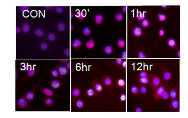 microglia 세포주인 BV2 세포주에 LPS를 처리한 후, 시간에 따라, HMGB1가 핵에서 세포질로 이동하는 양상을 형광 면역 염색을 통해서 조사함