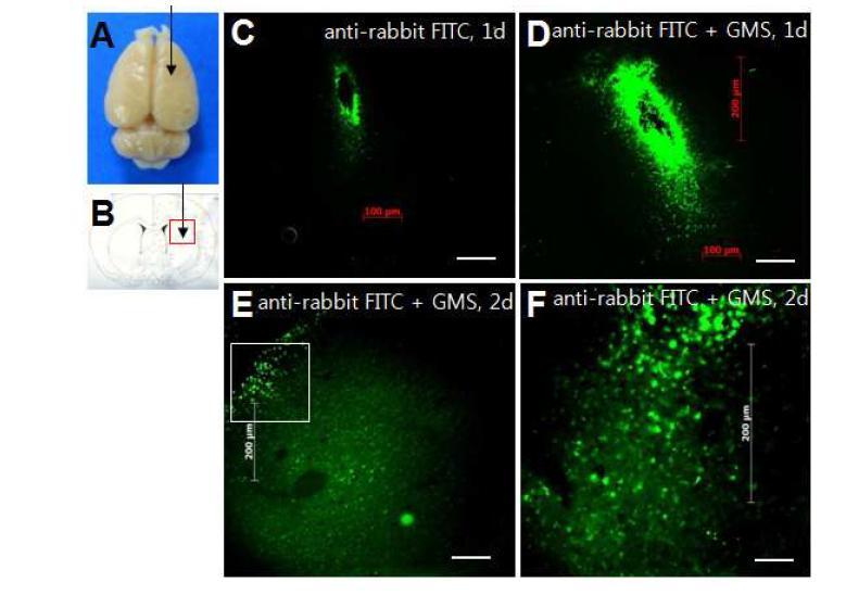 정상 뇌조직에 gelatin microsphere에 loading 한 FITC-표지된 Anti-rabbit IgG 2차항체를 투여한 후 1, 2일 후에 그 분포를 형광현미경으로 조사