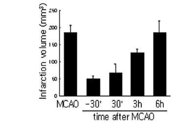 MCAO 동물 모델에 SNMC 1 ml/kg를 occlusion 전 또는 후에 투여하고 48 시간 후 TTC 염색을 통해 뇌경색 부피 측정