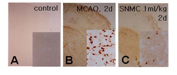MCAO 동물 모델에 SNMC 1 ml/kg를 occlusion 3 시간 후에 투여 하고 48 시간 후 microglia 염색을 통해염증 정도를 확인함