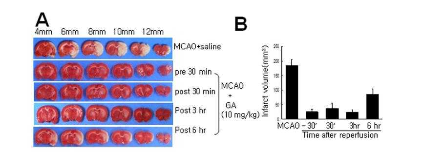 MCAO 동물 모델에서10 mg/kg GA를 혈관 결찰 30분전, 30분, 3시간, 6시간 후에 투여한후 48시간 후에 총 뇌경색 부피 조사