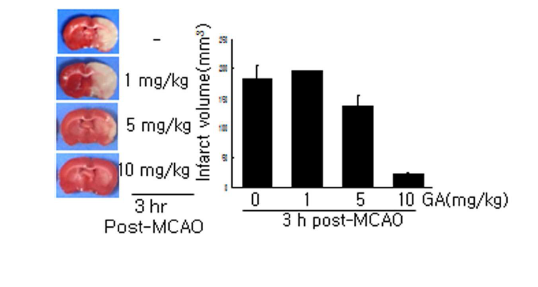 MCAO 동물 모델에서 혈관 결찰 3시간 후에 GA 1, 5, 10 mg/kg를 투여한후 48시간 후에 총 뇌경색 부피 조사