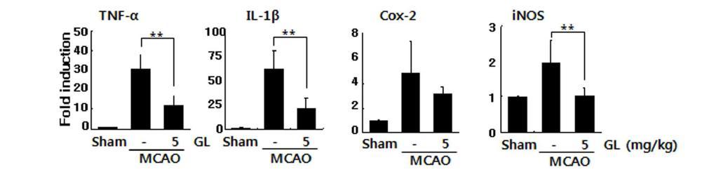 GA를 MCAO 동물 모델 제작 3 시간 후에 투여한 후, 24시간 후에 4 종류의 사이토카인 발현을 real time-PCR을 통하여 조사함.